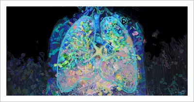 Seawater in My Lungs [PRINT], Onenhillion